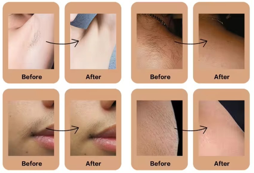 20240402224143 20240402224143